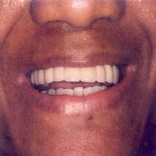 Cosmetic Dentist in Bronx, New York