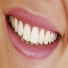 Teeth Whitening in Midlothian, Virginia