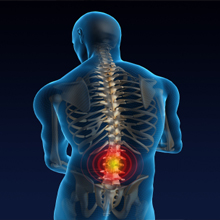 Lower Back Pain in Houston, Texas