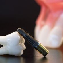 Hansen-Incarnati Dental Lab Photo