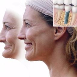 Denture Repair Service in Lighthouse Point, Florida