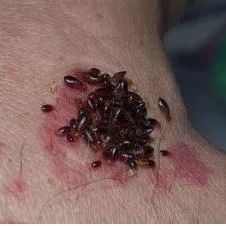 Bed Bug Exterminators in Salina, Kansas