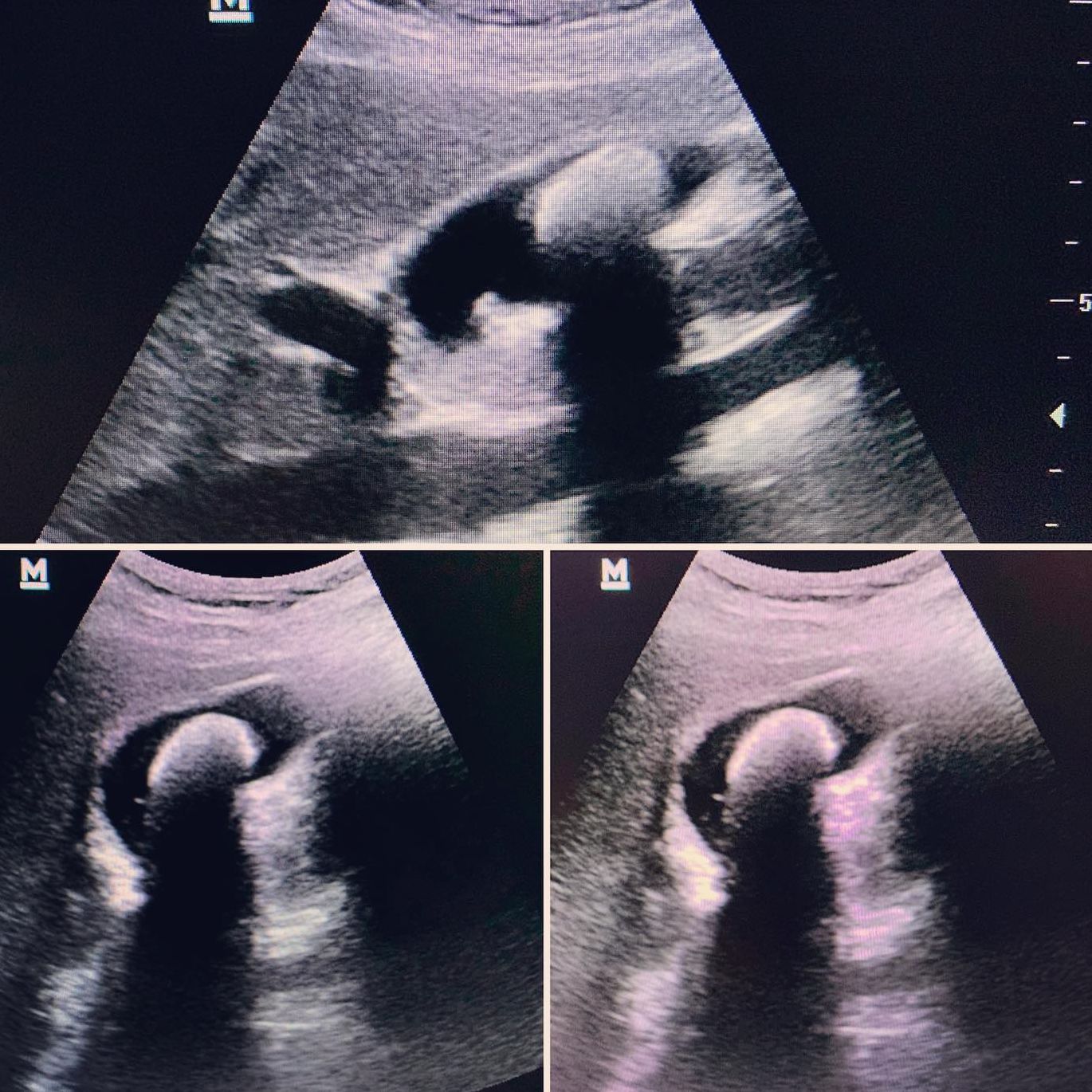 Pregnancy Ultrasound in Farmington Hills, Michigan