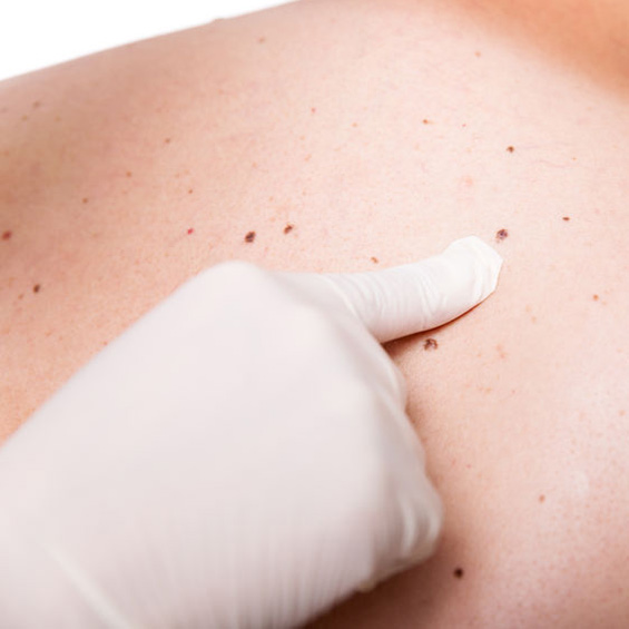 Dermatologists in Portland, OR