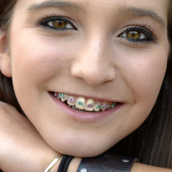 Orthodontist in Norcross, GA