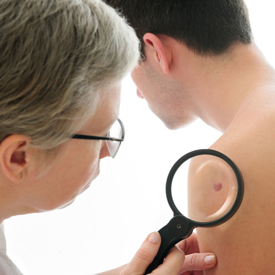 Psoriasis in Durham, North Carolina